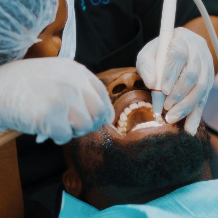 Teeth cleaning service